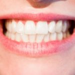 Profilaktyka czyli jak właściwie dbać o swoje zęby